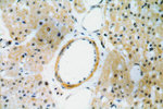 CYP26B1 Antibody in Immunohistochemistry (Paraffin) (IHC (P))