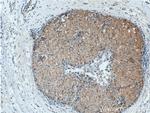 TUSC5 Antibody in Immunohistochemistry (Paraffin) (IHC (P))