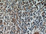LAX1 Antibody in Immunohistochemistry (Paraffin) (IHC (P))