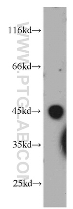 LAX1 Antibody in Western Blot (WB)