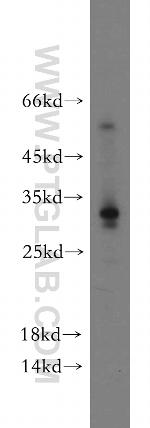 CCDC70 Antibody in Western Blot (WB)