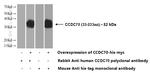 CCDC70 Antibody in Western Blot (WB)