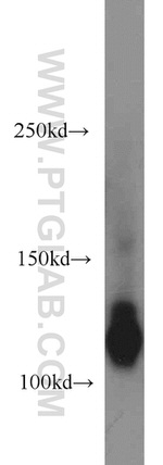 ATP8A1 Antibody in Western Blot (WB)