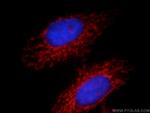 NAGS Antibody in Immunocytochemistry (ICC/IF)