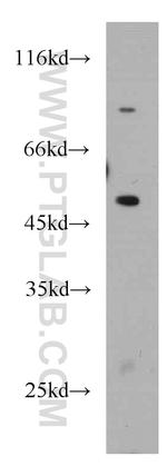 SLC25A25 Antibody in Western Blot (WB)