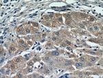 MOGAT1 Antibody in Immunohistochemistry (Paraffin) (IHC (P))