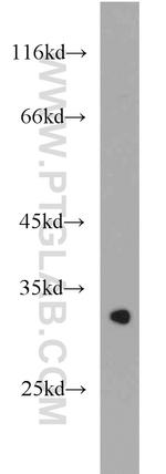 LRRC10 Antibody in Western Blot (WB)