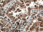 CYP2F1 Antibody in Immunohistochemistry (Paraffin) (IHC (P))