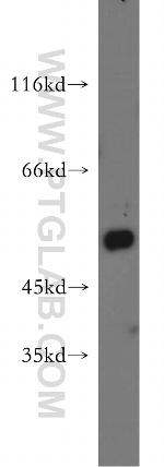 CYP2F1 Antibody in Western Blot (WB)