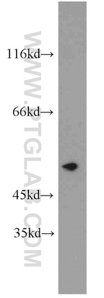 CYP2F1 Antibody in Western Blot (WB)