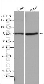 BTK Antibody in Western Blot (WB)