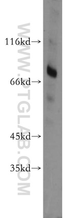 BTK Antibody in Western Blot (WB)