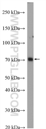 BTK Antibody in Western Blot (WB)