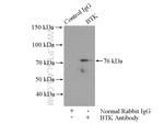 BTK Antibody in Immunoprecipitation (IP)