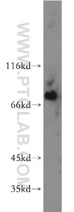 BTK Antibody in Western Blot (WB)