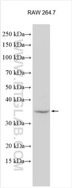 ZNF75D Antibody in Western Blot (WB)