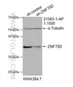 ZNF75D Antibody in Western Blot (WB)