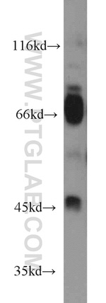 CHRFAM7A Antibody in Western Blot (WB)