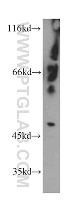 C7orf10 Antibody in Western Blot (WB)