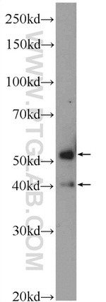 C7orf10 Antibody in Western Blot (WB)