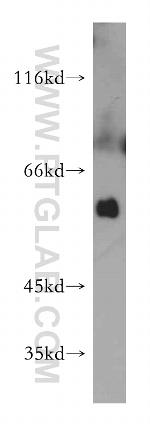 C7orf10 Antibody in Western Blot (WB)