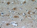 OGFOD2 Antibody in Immunohistochemistry (Paraffin) (IHC (P))