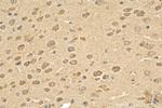 OGFOD2 Antibody in Immunohistochemistry (Paraffin) (IHC (P))