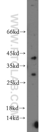 OGFOD2 Antibody in Western Blot (WB)