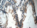 NGX6 Antibody in Immunohistochemistry (Paraffin) (IHC (P))