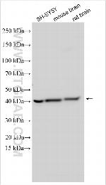 SPATA6L Antibody in Western Blot (WB)