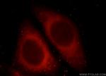 LRRC8C Antibody in Immunocytochemistry (ICC/IF)