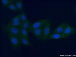 ALDH8A1 Antibody in Immunocytochemistry (ICC/IF)