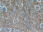 ALDH8A1 Antibody in Immunohistochemistry (Paraffin) (IHC (P))