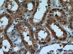 ALDH8A1 Antibody in Immunohistochemistry (Paraffin) (IHC (P))