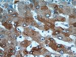 ALDH8A1 Antibody in Immunohistochemistry (Paraffin) (IHC (P))