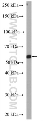 ALDH8A1 Antibody in Western Blot (WB)