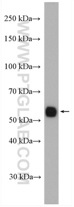 ALDH8A1 Antibody in Western Blot (WB)