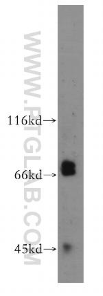 IL1RAPL1 Antibody in Western Blot (WB)