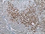 ADIPOQ Antibody in Immunohistochemistry (Paraffin) (IHC (P))