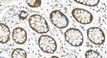 MRP63 Antibody in Immunohistochemistry (Paraffin) (IHC (P))