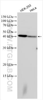 MRP63 Antibody in Western Blot (WB)