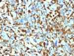 Factor XIIIa (Coagulation Factor XIIIA Chain) Monoclonal Antibody (F13A1, 1448)
