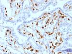 Factor XIIIa (Coagulation Factor XIIIA Chain) Antibody in Immunohistochemistry (Paraffin) (IHC (P))