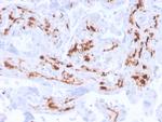 Factor XIIIa (Coagulation Factor XIIIA Chain) Recombinant Rabbit Monoclonal Antibody (F13A1, 3772R)