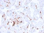 Factor XIIIa (Coagulation Factor XIIIA Chain) Antibody in Immunohistochemistry (Paraffin) (IHC (P))