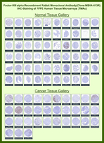 Factor XIIIa (Coagulation Factor XIIIA Chain) Recombinant Rabbit Monoclonal Antibody (MSVA-813R)