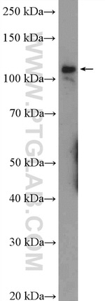 RNF20 Antibody in Western Blot (WB)