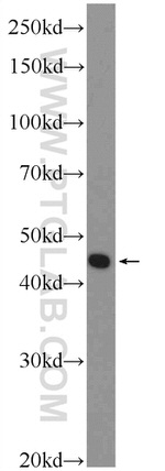 ZDHHC15 Antibody in Western Blot (WB)