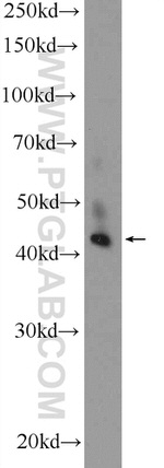 ZDHHC15 Antibody in Western Blot (WB)