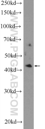 ZDHHC15 Antibody in Western Blot (WB)